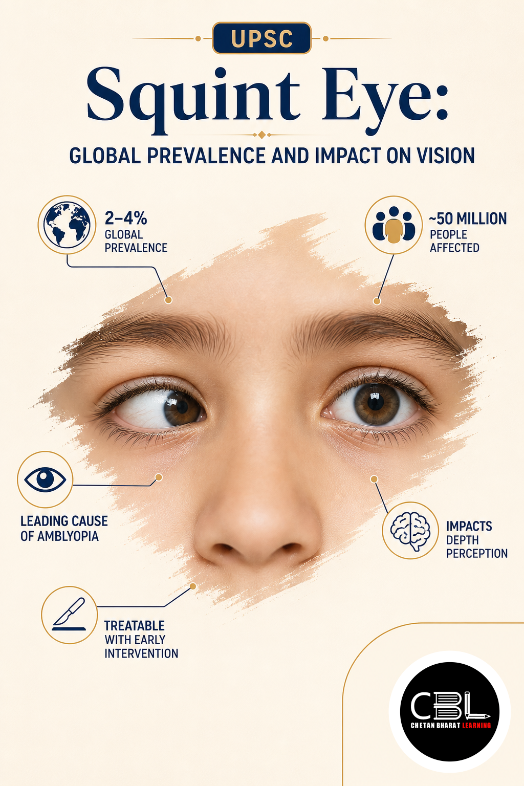 squint eye explained for UPSC aspirants